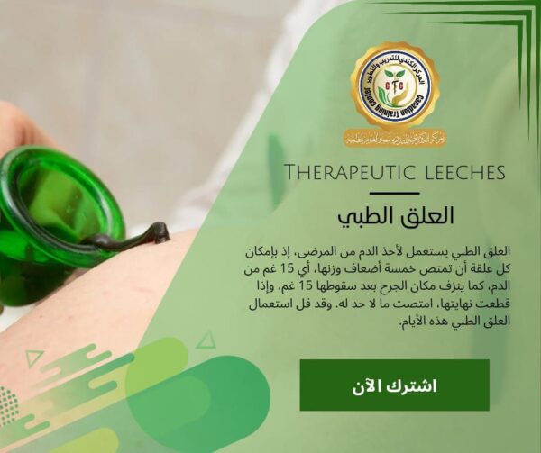 ⁦دبلوم العلاج بالعلق الطبي 🐛⁩ - الصورة ⁦2⁩